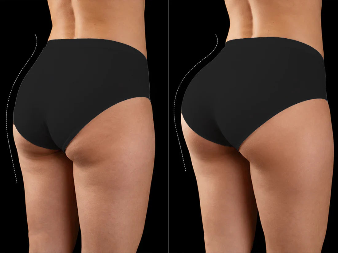 Flatness before and after