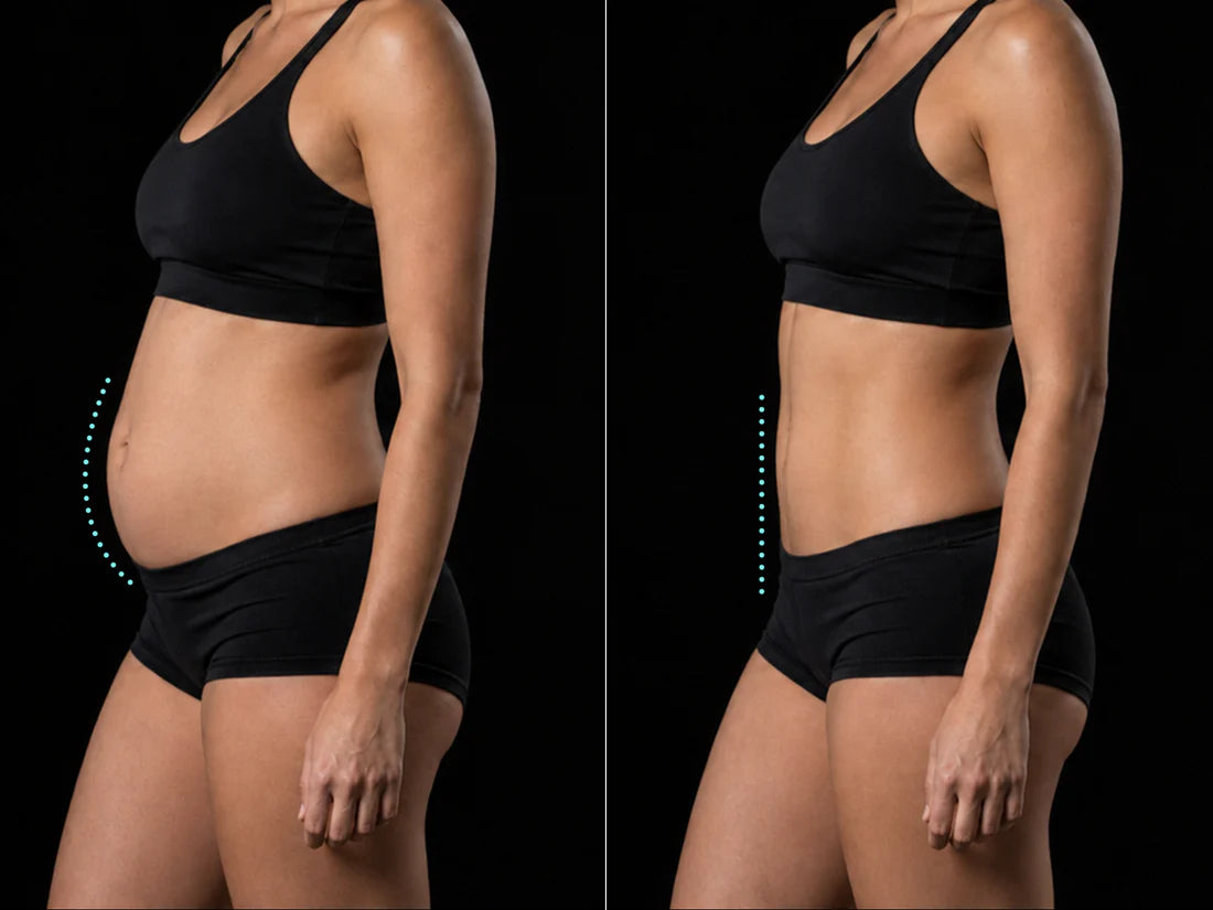 Bloating before and after